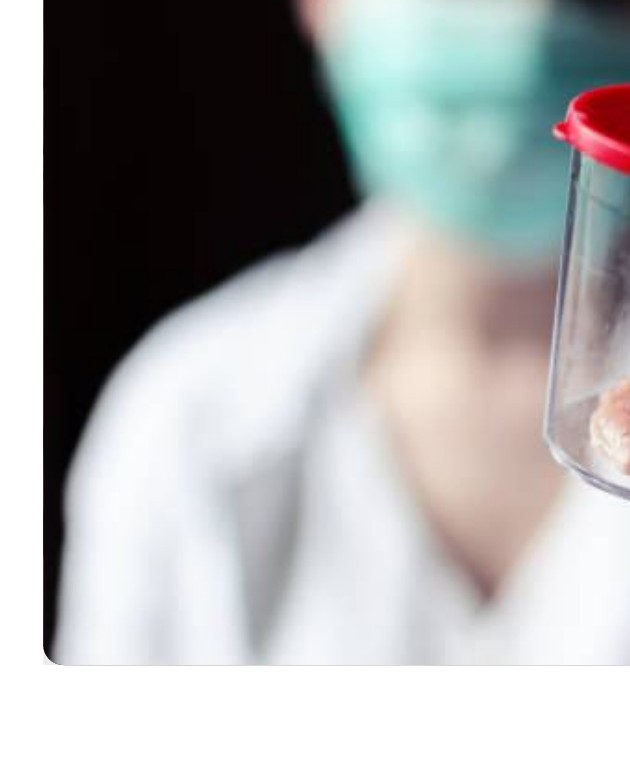 Muestra de biopsia
